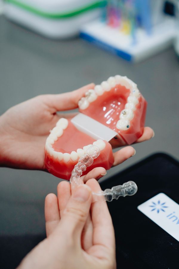 A clear aligner tray held next to a dental model