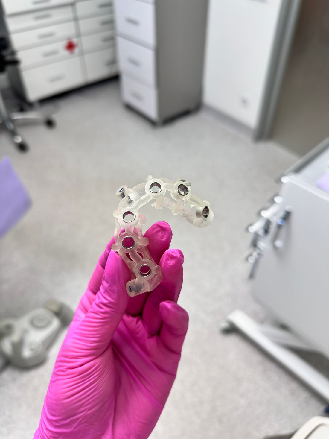 A transparent implant surgical guide with metal drill sleeves held in a gloved hand