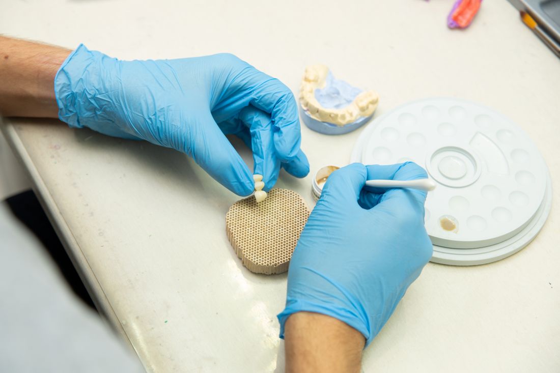 Dental technician working on a tooth-colored ceramic restoration